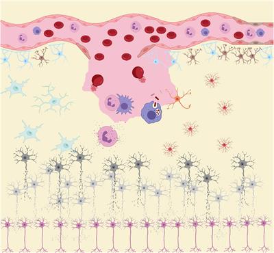 Inflammation and Oxidative Stress: Potential Targets for Improving Prognosis After Subarachnoid Hemorrhage